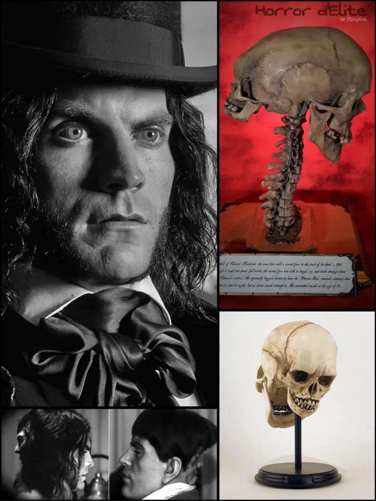 Edward Mordrake, El Hombre de Dos Caras